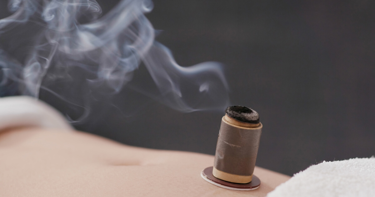Moxibustion: Techniques, Benefits, and Acupuncture Insights
