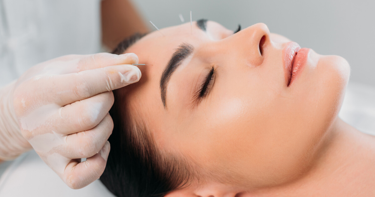 Bringing AcuNova Acupuncture to Long Island for Degenerative Eye Conditions